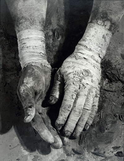 Die Befreiung der Finger (Liberation of the Fingers)