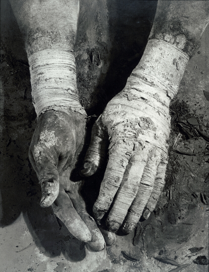 Die Befreiung der Finger (Liberation of the Fingers)