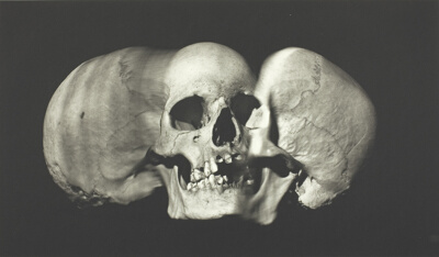 Wide Skull (A), New York