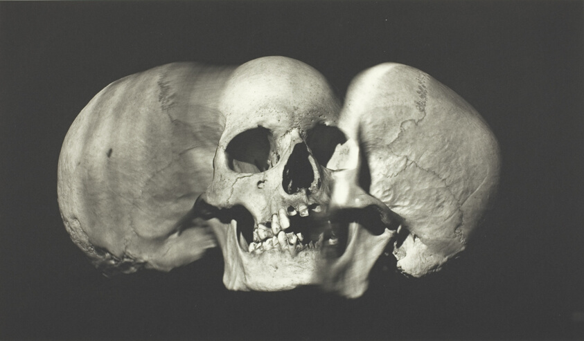 Wide Skull (A), New York
