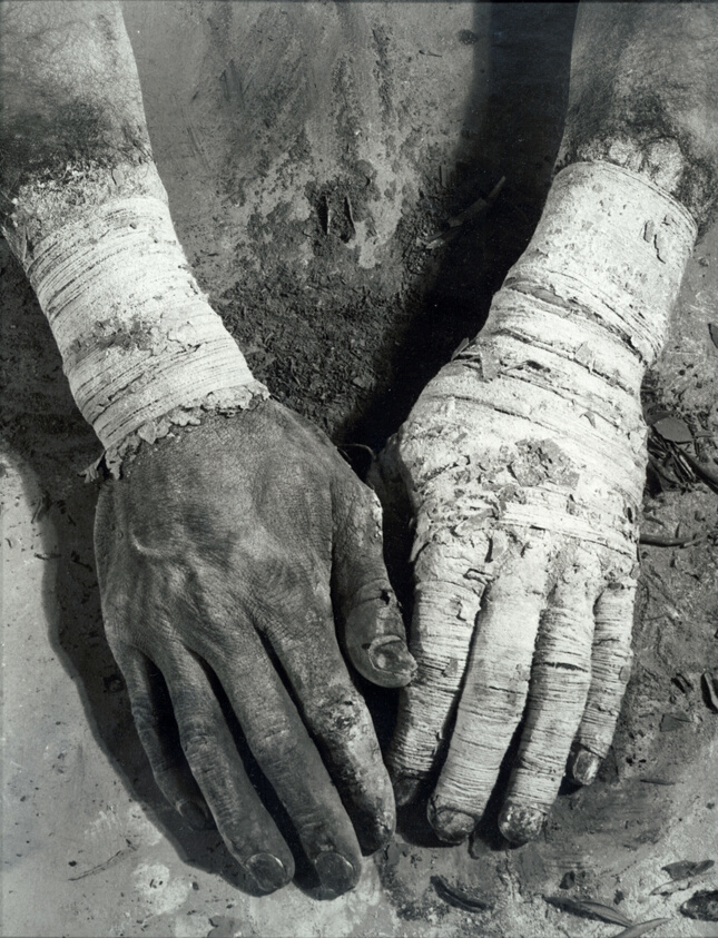 Die Befreiung der Finger (Liberation of the Fingers)