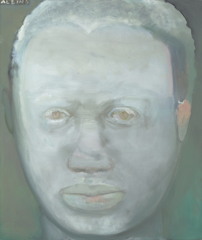 Albino