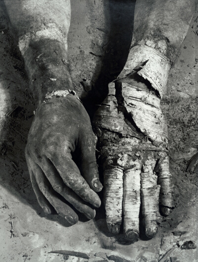 Die Befreiung der Finger (Liberation of the Fingers)
