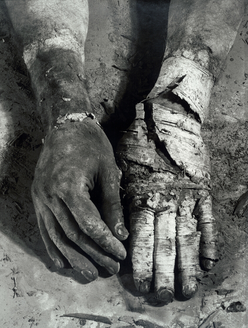 Die Befreiung der Finger (Liberation of the Fingers)