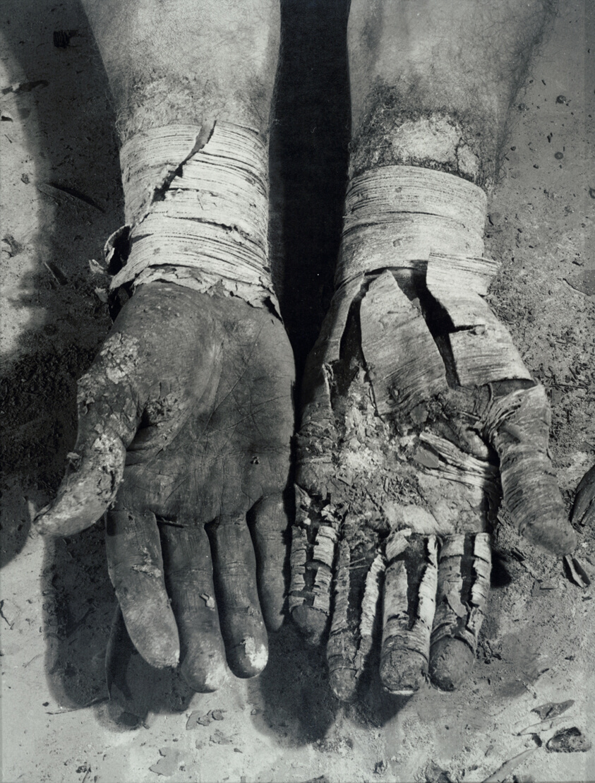 Die Befreiung der Finger (Liberation of the Fingers)